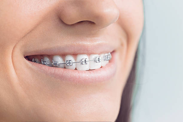 Best Traditional Braces  in Athens, IL